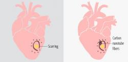 Schema „První in vivo rekonstrukce přirozeného elektrického signálu pomocí syntetického materiálu“. Kredit: Texas Heart Institute.