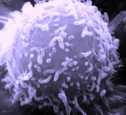 T – lymfocyt. Elektrónová mikroskopia. Kredit: Dr. Triche National Cancer Institute.