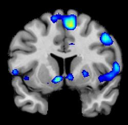 Spirituální prožitky mocně stimulují centrum odměny. (Kredit: Anderson lab. Univ. Utah)