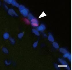 Štěpu lidských iPS buněk v opičím mozku se daří dobře a začíná se ujímat svých funkcí s tvorbou dopaminu. Kredit: Kikuchi et al., Kyoto Univ., 2017.