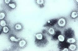 Koronavirus HCoV-OC43 by mohl být polepšeným zabijákem. Kredit: CDC/Erskine Palmer.