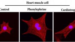 Cardiotrophin 1 stimuluje rast buniek srdcového svalu - vznikajú dlhé zdravé vlákna (obr. vpravo). Srdcové ochorenia vedú k nefyziologickému rastu svalu (stredný obrázok).