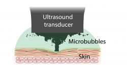 Bioadhezi zprostředkovávají ultrazvukem indukované mikrobubliny. Kredit: Zhenwei Ma.