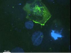 Infikovaná T buňka (zelená) atakuje slizniční buňku lidské předkožky (dobře patrné je z buňky jen její blankytně modré jádro). To, co zpočátku vypadá jako vzájemné „očichávání“ s pomalým přibližováním se, je ve skutečnosti vytváření synapse mezi buňkami. Tato fáze trvá zhruba dvě hodiny, pak teprve dojde na harpunaci.