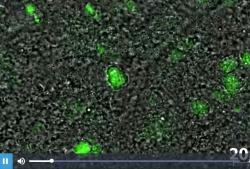 Ukázka přeškolení buněk Cdx2  ve funkční kardiomyocyty schopné synchronizovat své stahy a zapojit se do tlukotu srdce. Další videa zde. Kredit: Sangeetha Vadakke-Madathil, PNAS, 2019.