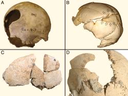 V neolitu bylo násilí všudypřítomné. Kredit: Fibiger et al. (2023), PNAS.