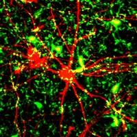 Neposedné imunitní buňky mikroglie v mozku neustále šmejdí. Mikroglie jsou zelené, neuron červený. Pokud na svém povrchu vytvoří hodně receptorů CD22, zleniví a přestanou o neurony pečovat. Mozek se stává málo výkonným. Zablokování receptorů protilátkou přivádí buňky zpět k jejich povinnostem a mozek to ocení navratem do své původní formy  (Kredit: Martin Fuhrmann, Deutsches Zentrum für Neurodegenerative Erkrankungen e.V.)