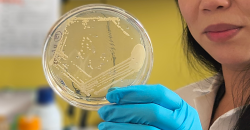 Při zjištění alkoholu v krvi by test stolice mohl sloužit jako diagnostika syndromu ABS. Kredit: UC San Diego Health Sciences.