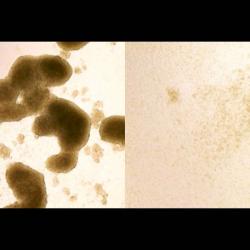 Vlevo kmenové buňky glioblastomu, vpravo situace po akci ziky. Kredit: Zhe Zhu / WUSTL.
