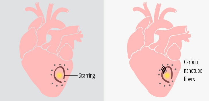 Schema „První in vivo rekonstrukce přirozeného elektrického signálu pomocí syntetického materiálu“. Kredit: Texas Heart Institute.