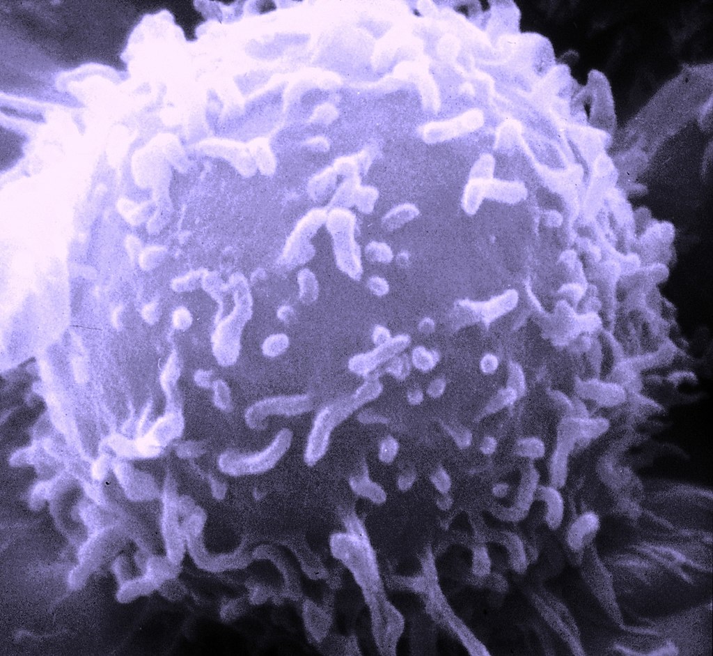 T – lymfocyt. Elektrónová mikroskopia. Kredit: Dr. Triche National Cancer Institute.