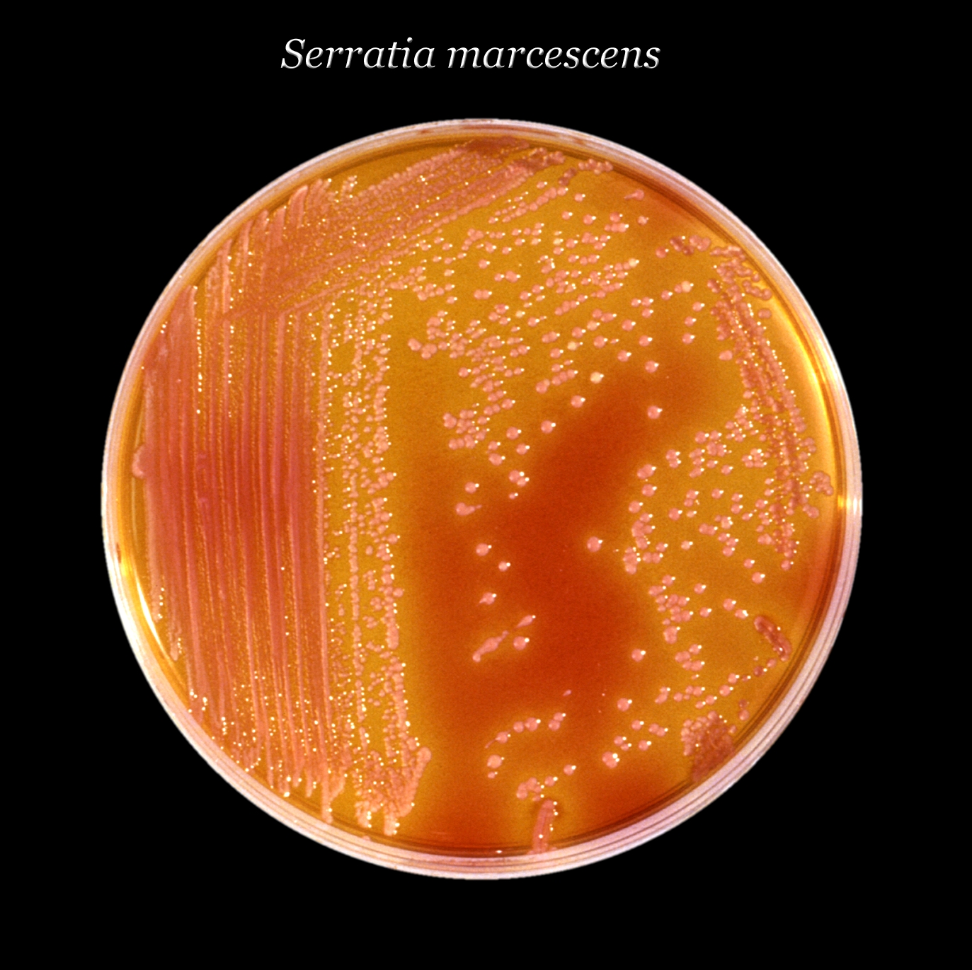 Kolonie bakterie Serratia marcescens (zde na agaru), dokĂˇĹľe napadat sliznice zaĹľĂ­vacĂ­ho, dĂ˝chacĂ­ho i moÄŤovĂ©ho ĂşstrojĂ­. BĂ˝vĂˇ ÄŤastĂ˝m hostem sprch, toalet a zvlĂˇĹˇtÄ› dÄ›tĹˇtĂ­ pacienti si ji rĂˇdi nosĂ­ jako komplikaci, z nemocnice domĹ
