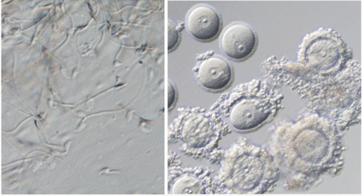 Vlevo spermie vypěstované z kmenových buněk, vpravo vajíčka vypěstovaná z kmenových buněk. Kredit: Saitou, ICEMS.