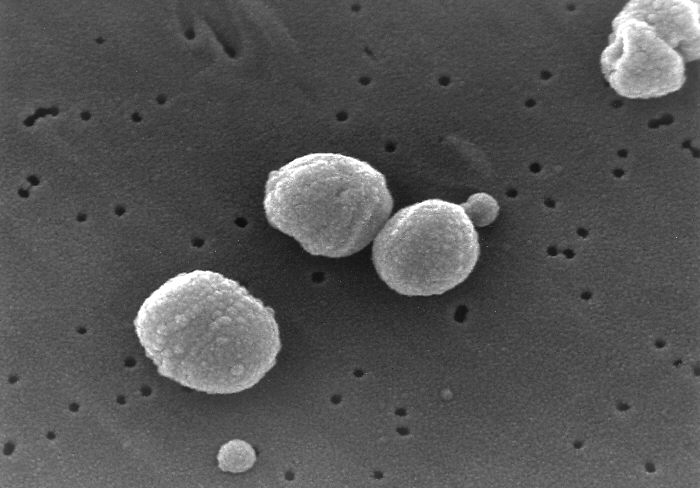 Streptococcus pneumoniae (též pneumococcus), je kulovitá (kok) bakterie kolonizující sliznici horních cest dýchacích.  Je to podmíněný patogen a původce závažných pneumonií a meningitid.  Kredit: CDC / Janice Carr, volné dílo.