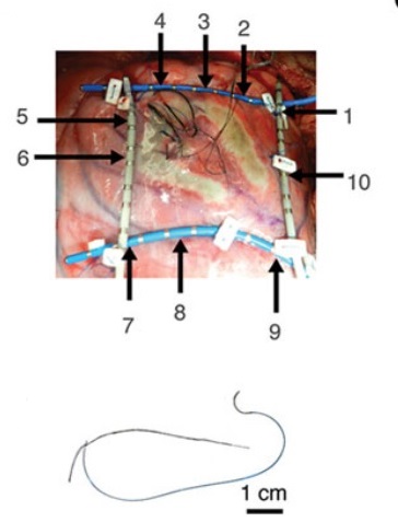 Fotografie ukazuje ovčí srdce s vláknem CNTf všitým přes půlkruhovou jizvu a její vodivé přemostění. Rovné dlouhé útvary okolo jizvy jsou měřící snímací katétry (pro potřebu pokusu). Čísla 1–10 odpovídají poloze bipolárních elektrogramů. Reprezentati