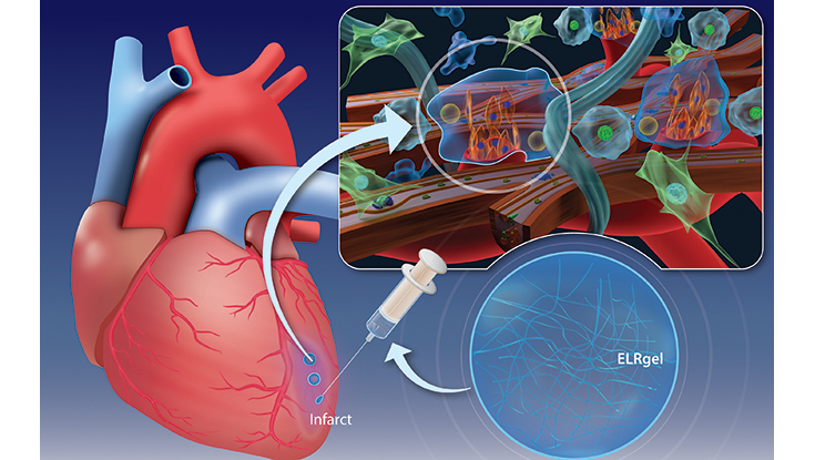 Grafické schéma nové léčebné metody infarktu. Kredit: CÚRAM.