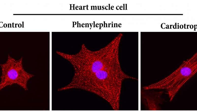Cardiotrophin 1 stimuluje rast buniek srdcového svalu - vznikajú dlhé zdravé vlákna (obr. vpravo). Srdcové ochorenia vedú k nefyziologickému rastu svalu (stredný obrázok).