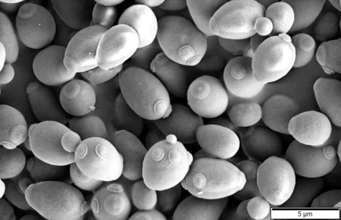 Saccharomyces cerevisiae, snímek z elektronového mikroskopu. Kredit: v Mogana Das Murtey a Patchamuthu Ramasamy, Wikipedia.  https://en.wikipedia.org/wiki/Saccharomyces_cerevisiae