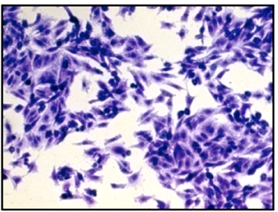 Mycoplasma genitalium je takĂ© extra nicotnĂ˝m organismem. NemĂˇ uĹľ ani svou vlastnĂ­ bunÄ›ÄŤnou stÄ›nu. Neobejde se proto bez vlĂˇskovĂ˝ch bunÄ›k krycĂ­ tkĂˇnÄ› urogenitĂˇlnĂ­ho traktu. DĹŻvÄ›rnÄ› se s jejĂ­m svÄ›dÄ›nĂ­m, pĂˇlenĂ­m ÄŤi vĂ˝tokem, se