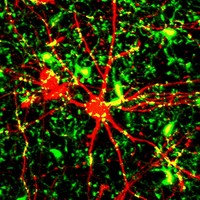 Neposedné imunitní buňky mikroglie v mozku neustále šmejdí. Mikroglie jsou zelené, neuron červený. Pokud na svém povrchu vytvoří hodně receptorů CD22, zleniví a přestanou o neurony pečovat. Mozek se stává málo výkonným. Zablokování receptorů protilát