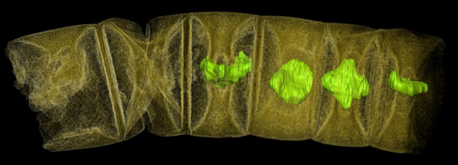 Snímek fosilie odpovídající stonku červené řasy pořízený tomografem (Synchrotron-Radiation X-ray Tomographic Microscopy).Obraz je elektronicky dobarven. Kredit: Stefan Bengtson et al. 2017)