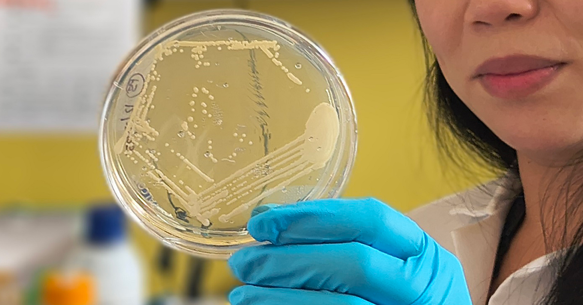 Při zjištění alkoholu v krvi by test stolice mohl sloužit jako diagnostika syndromu ABS. Kredit: UC San Diego Health Sciences.