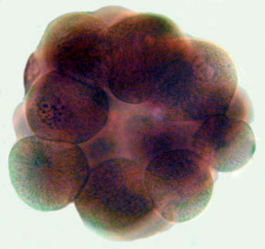 embryo