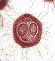 mimivirus