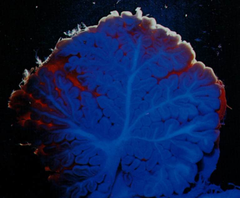 strom mozku