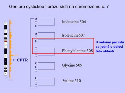 cystická fibróza